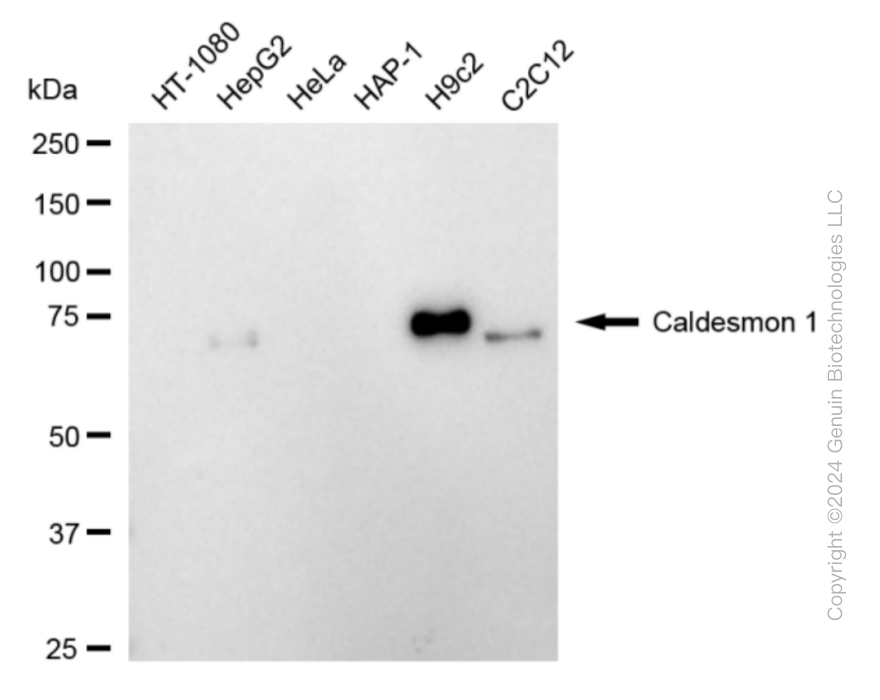KD-Validated Anti-Caldesmon 1 Rabbit Monoclonal Antibody ABG1852