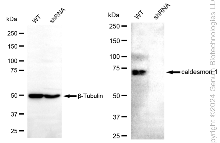 KD-Validated Anti-Caldesmon 1 Rabbit Monoclonal Antibody ABG1852