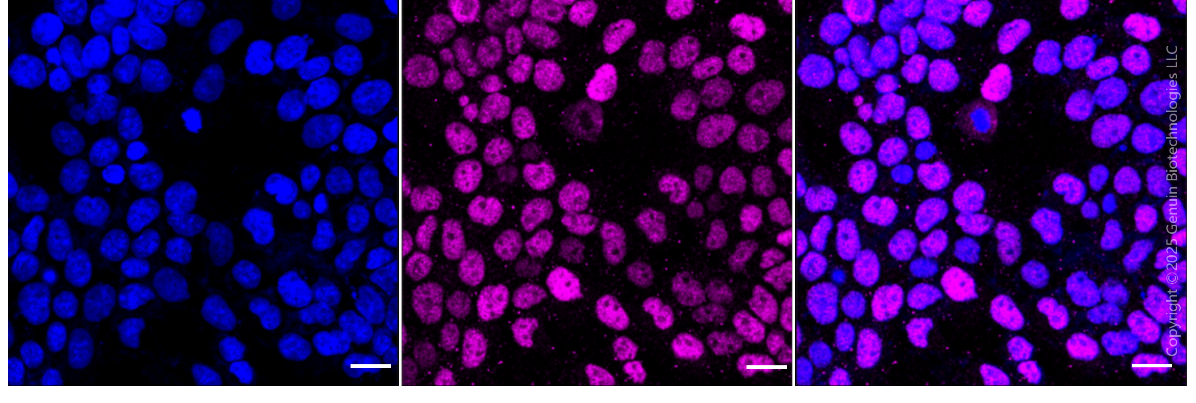 KD-Validated Anti-Cyclin E1 Rabbit Monoclonal Antibody ABG1854