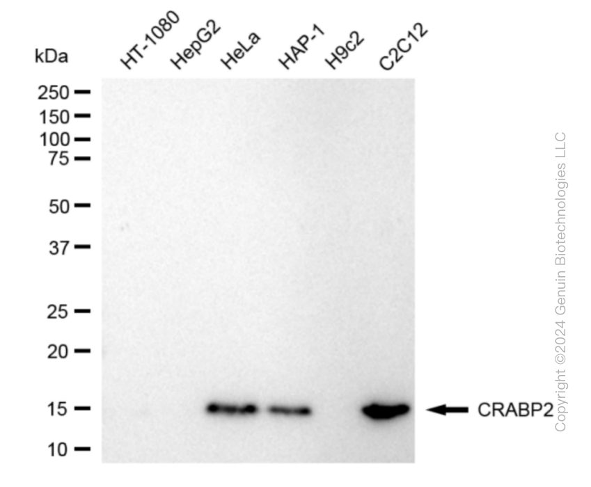 KD-Validated Anti-CRABP2 Rabbit Monoclonal Antibody ABG1859