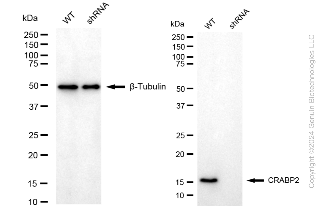 KD-Validated Anti-CRABP2 Rabbit Monoclonal Antibody ABG1859