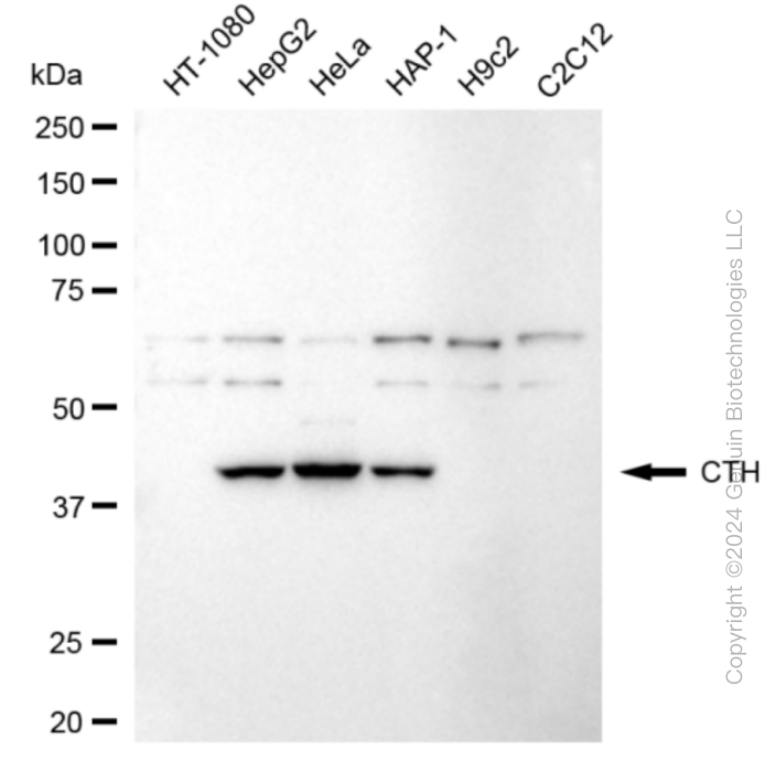 KD-Validated Anti-Cystathionine Gamma-Lyase Rabbit Monoclonal Antibody ABG1860
