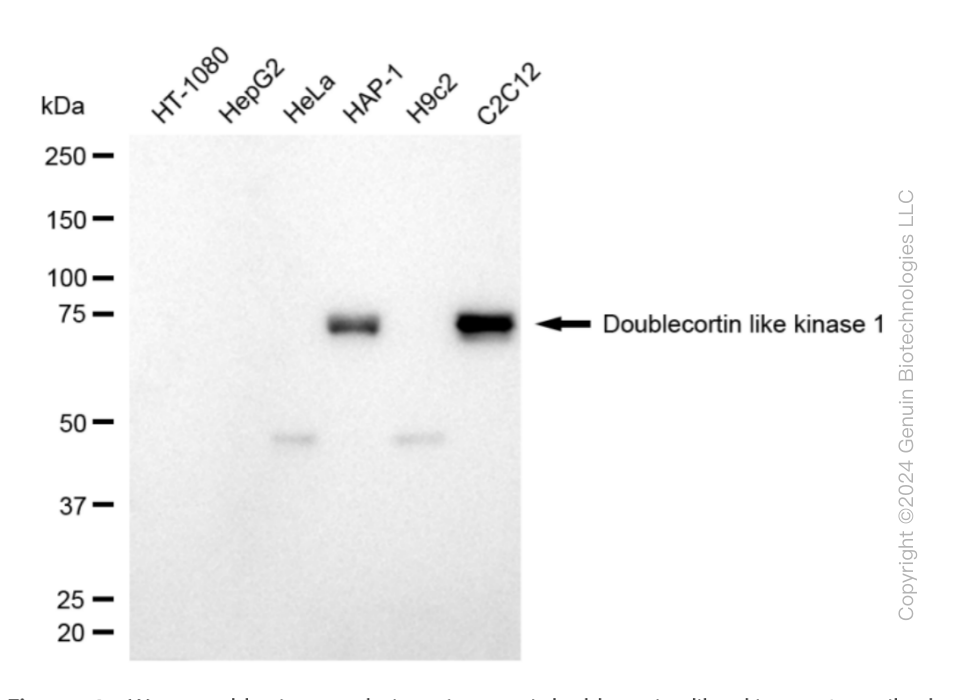 KD-Validated Anti-Doublecortin Like Kinase 1 Rabbit Monoclonal Antibody ABG1861
