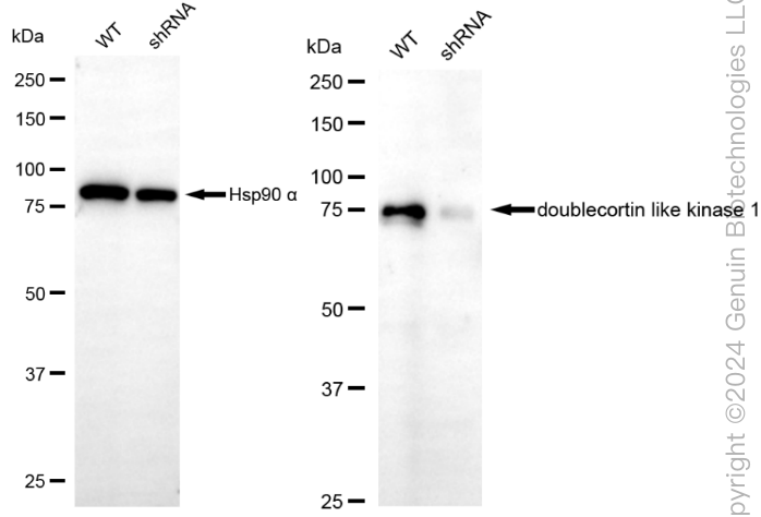 KD-Validated Anti-Doublecortin Like Kinase 1 Rabbit Monoclonal Antibody ABG1861