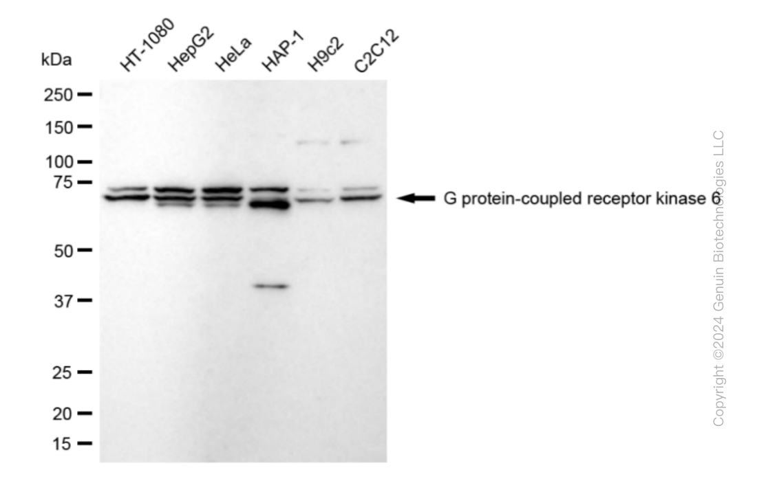 KD-Validated Anti-G Protein-Coupled Receptor Kinase 6 Rabbit Monoclonal Antibody ABG1865