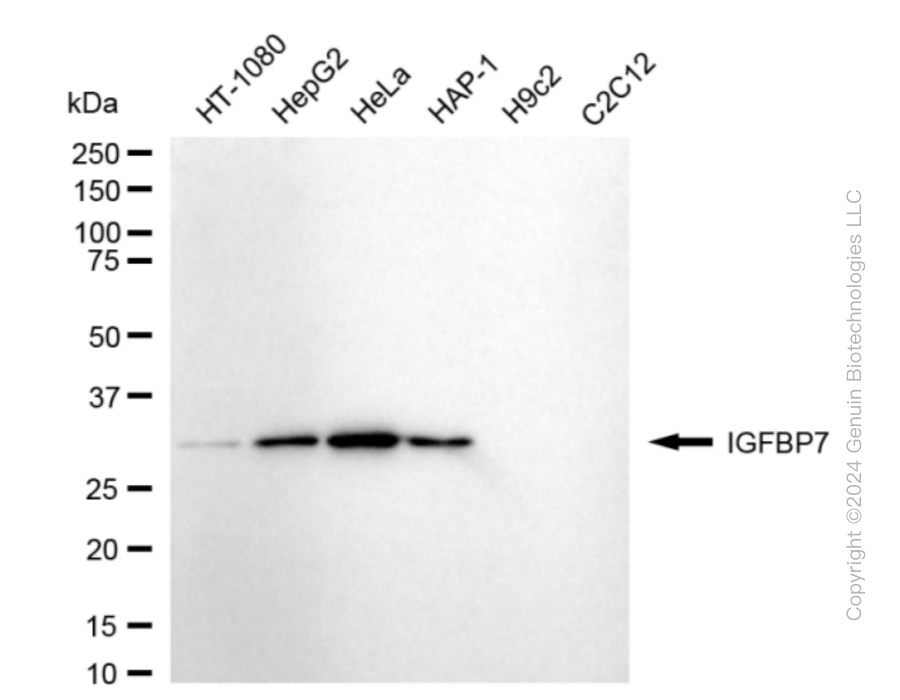 KD-Validated Anti-IGFBP7 Rabbit Monoclonal Antibody ABG1866