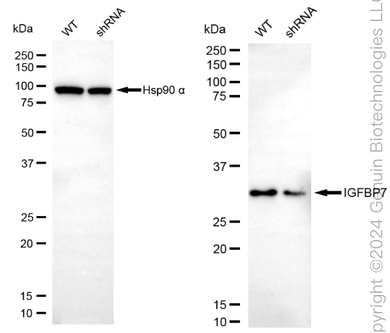 KD-Validated Anti-IGFBP7 Rabbit Monoclonal Antibody ABG1866