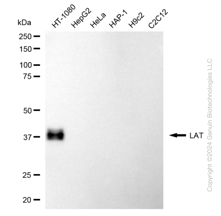 KD-Validated Anti-Linker For Activation Of T Cells Rabbit Monoclonal Antibody ABG1868