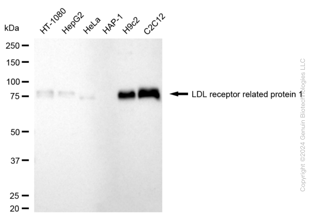 KD-Validated Anti-LDL Receptor Related Protein 1 Rabbit Monoclonal Antibody ABG1869