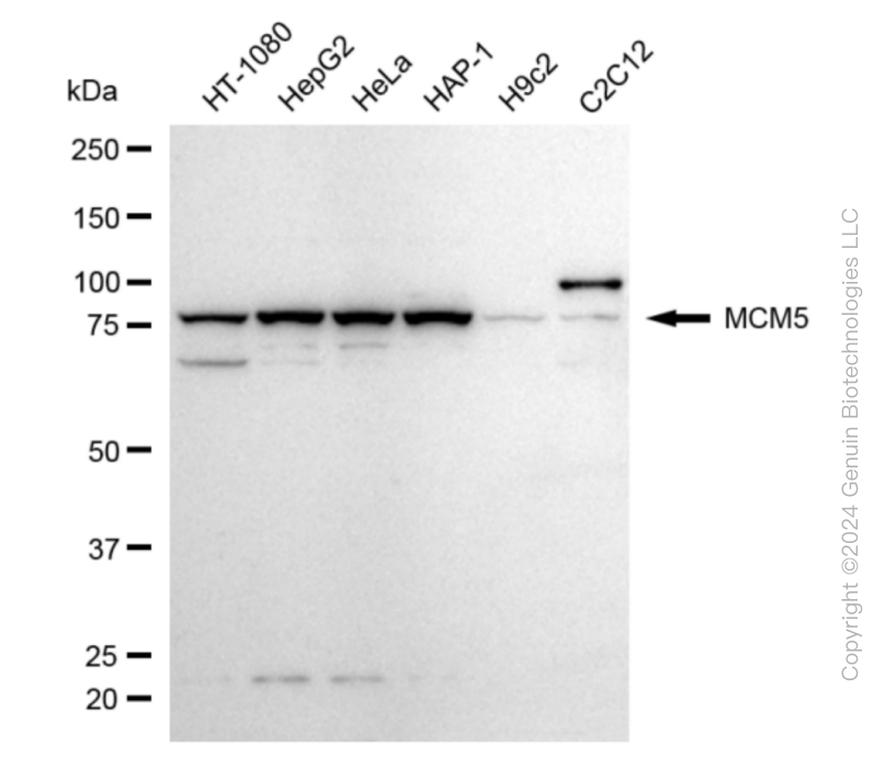 KD-Validated Anti-MCM5 Rabbit Monoclonal Antibody ABG1871