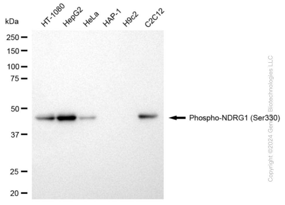 KD-Validated Anti-Phospho-NDRG1 (Ser330) Rabbit Monoclonal Antibody ABG1873