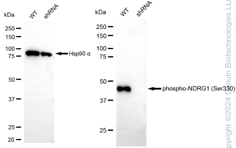 KD-Validated Anti-Phospho-NDRG1 (Ser330) Rabbit Monoclonal Antibody ABG1873