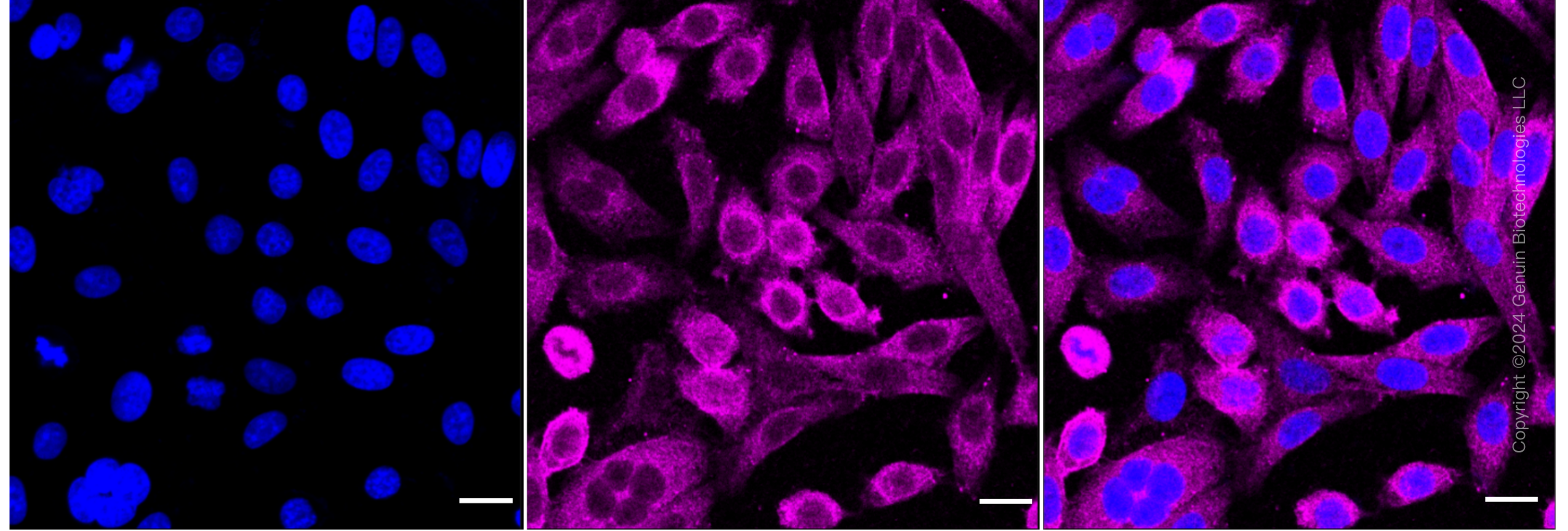 KD-Validated Anti-Pro-Apoptotic WT1 Regulator Rabbit Monoclonal Antibody ABG1874