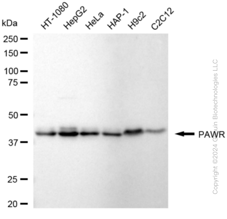 KD-Validated Anti-Pro-Apoptotic WT1 Regulator Rabbit Monoclonal Antibody ABG1874