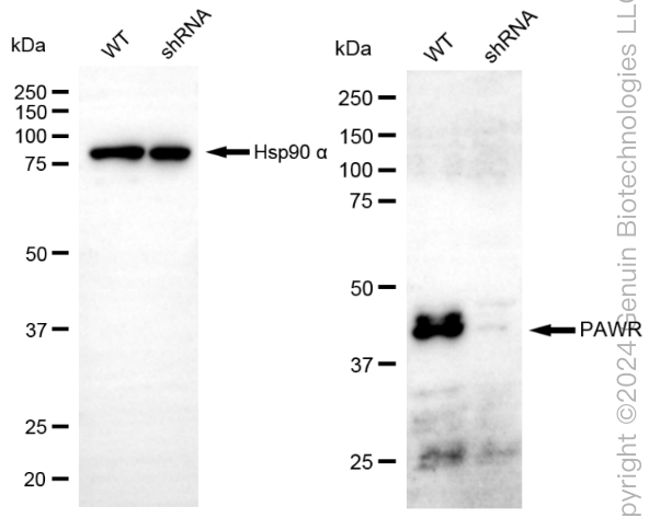 KD-Validated Anti-Pro-Apoptotic WT1 Regulator Rabbit Monoclonal Antibody ABG1874