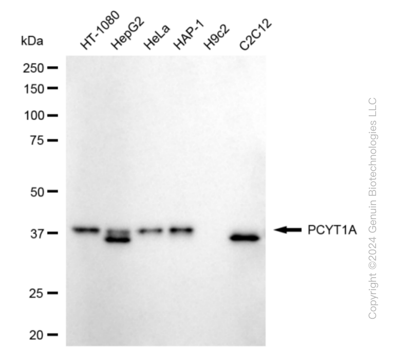 KD-Validated Anti-PCYT1A Rabbit Monoclonal Antibody ABG1875