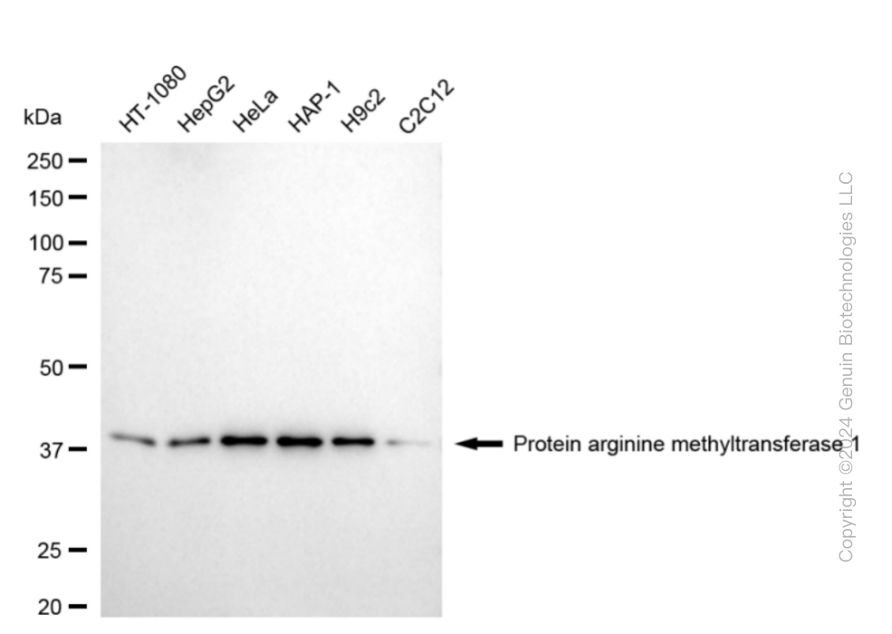 KD-Validated Anti-PRMT1 Rabbit Monoclonal Antibody ABG1876