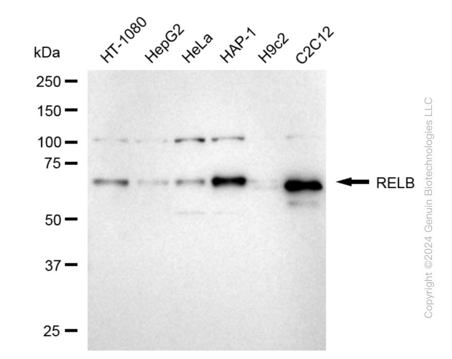 KD-Validated Anti-RELB Rabbit Monoclonal Antibody ABG1878