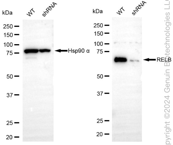 KD-Validated Anti-RELB Rabbit Monoclonal Antibody ABG1878