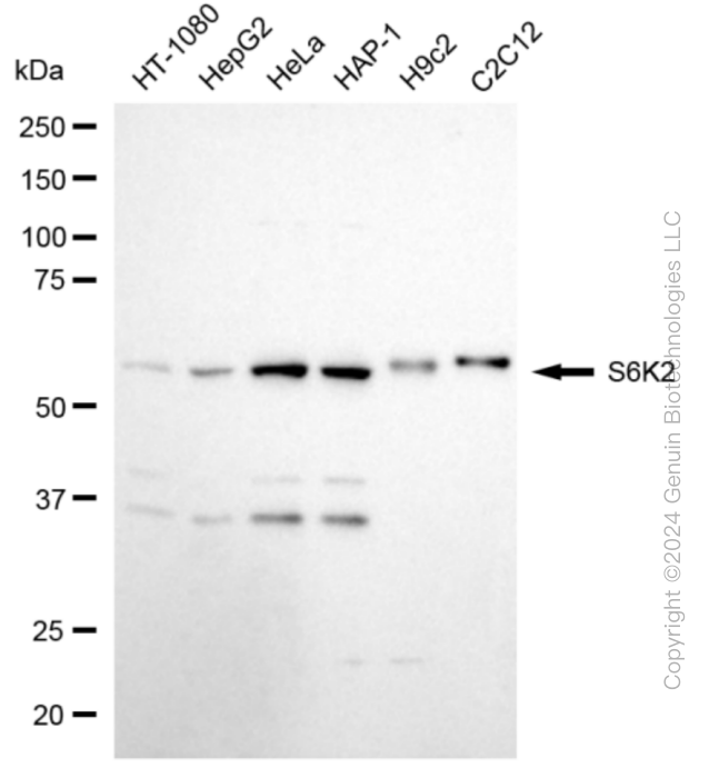 KD-Validated Anti-Ribosomal Protein S6 Kinase B2 Rabbit Monoclonal Antibody ABG1879