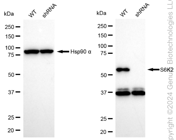 KD-Validated Anti-Ribosomal Protein S6 Kinase B2 Rabbit Monoclonal Antibody ABG1879