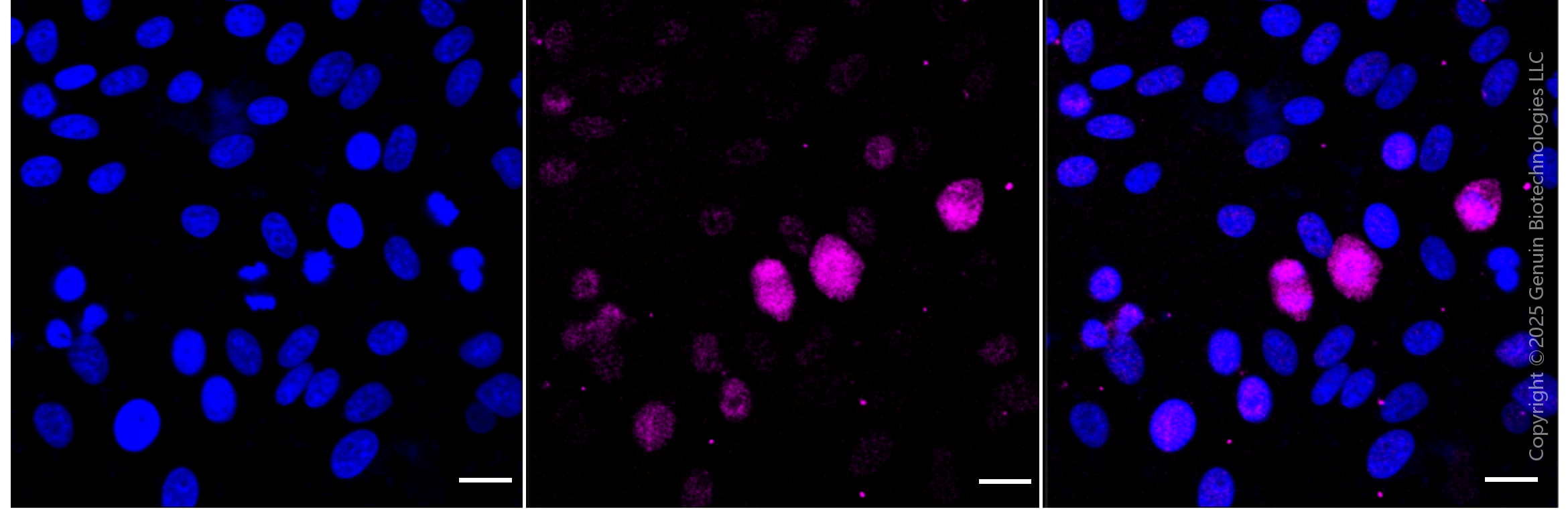 KD-Validated Anti-Phospho-HSF1 (Ser326) Rabbit Monoclonal Antibody ABG1885