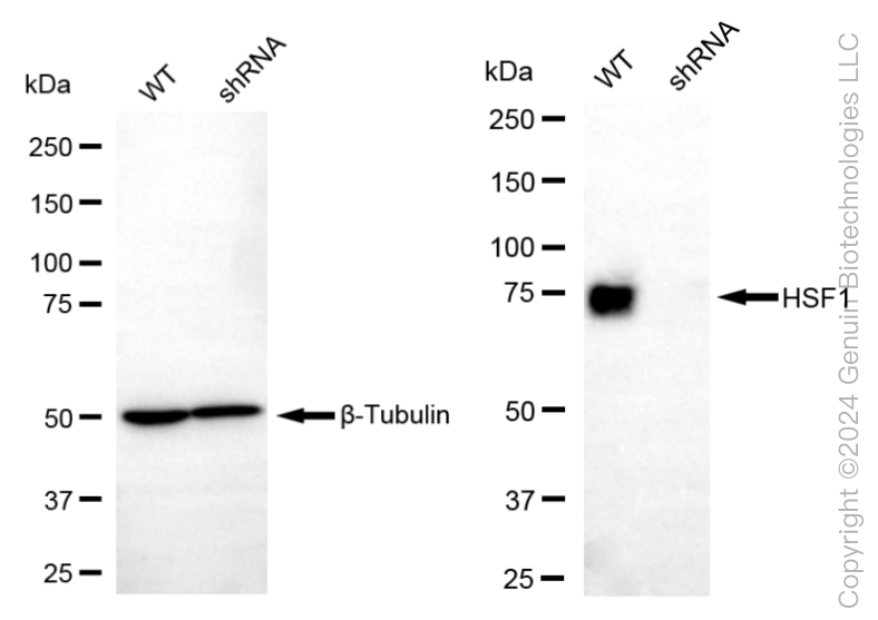 KD-Validated Anti-Heat Shock Transcription Factor 1 Rabbit Monoclonal Antibody ABG1886
