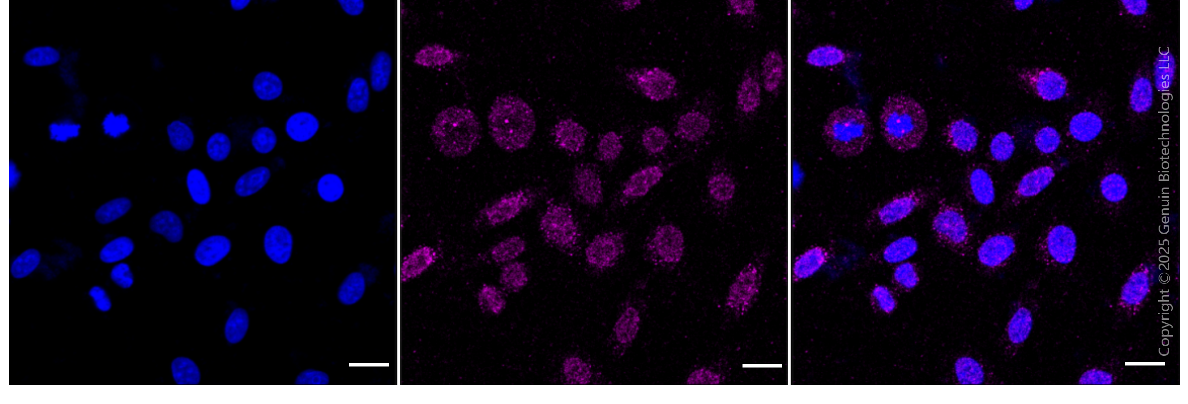 KD-Validated Anti-ALPP Rabbit Monoclonal Antibody ABG1888