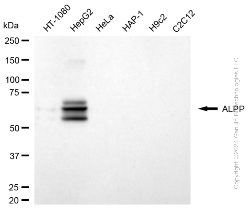 KD-Validated Anti-ALPP Rabbit Monoclonal Antibody ABG1888