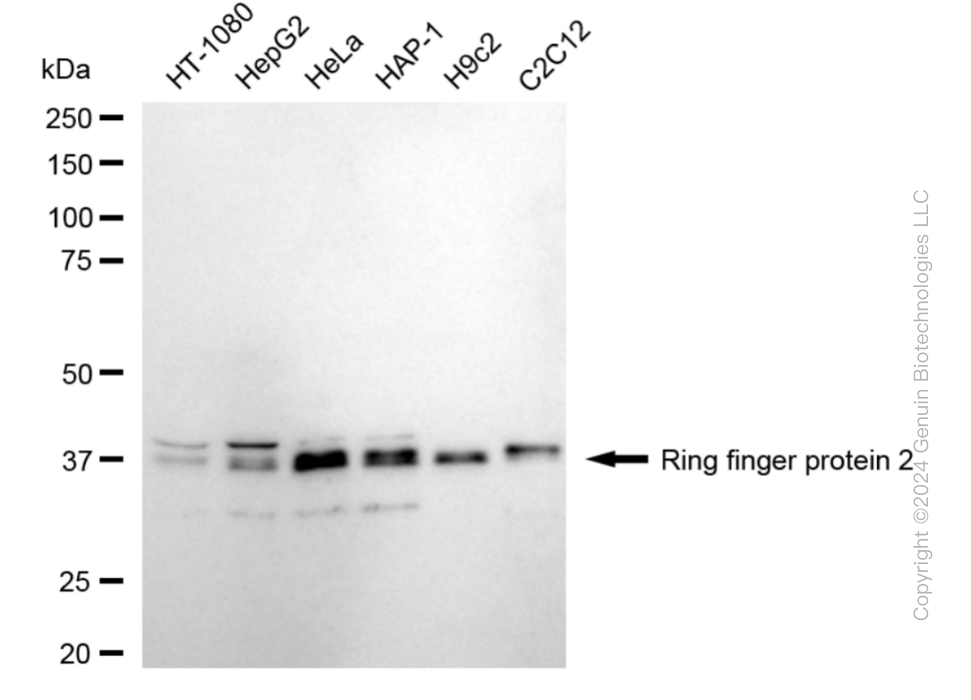 KD-Validated Anti-Ring Finger Protein 2 Rabbit Monoclonal Antibody ABG1891