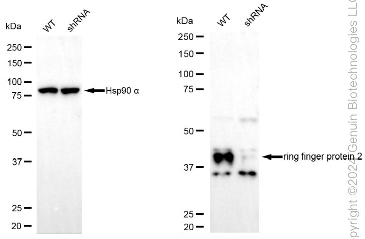KD-Validated Anti-Ring Finger Protein 2 Rabbit Monoclonal Antibody ABG1891