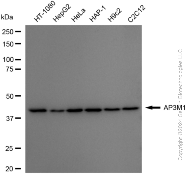 KD-Validated Anti-AP3M1 Rabbit Monoclonal Antibody ABG1893