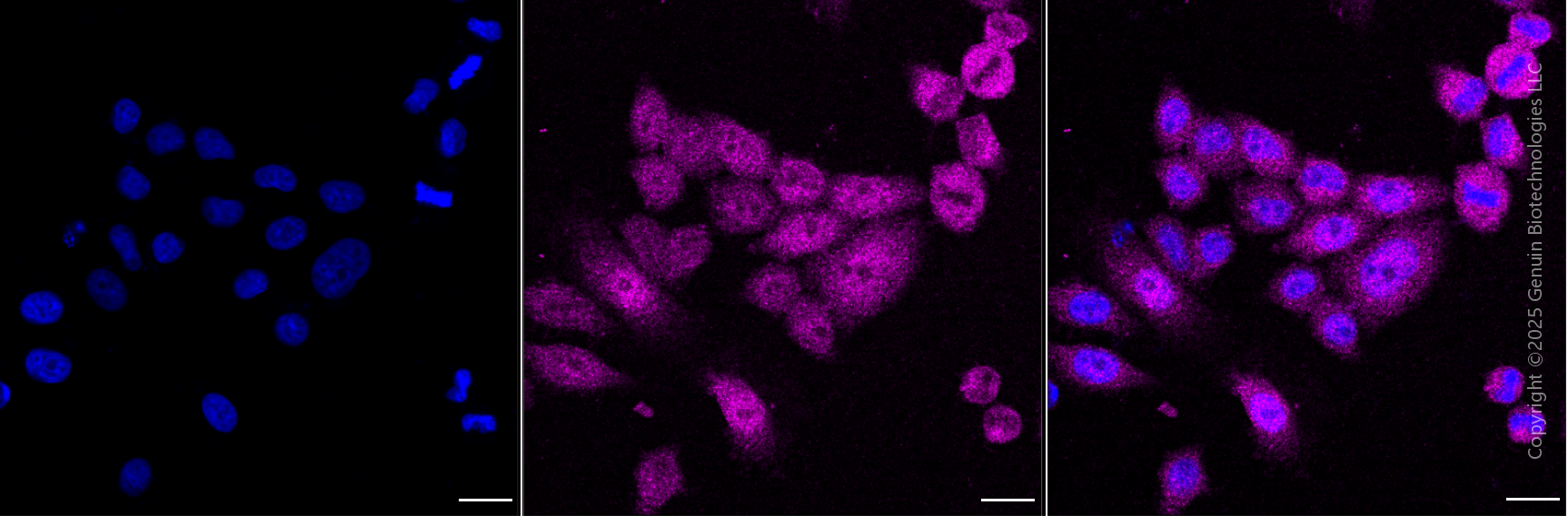 KD-Validated Anti-STAT3 Mouse Monoclonal Antibody ABG1896