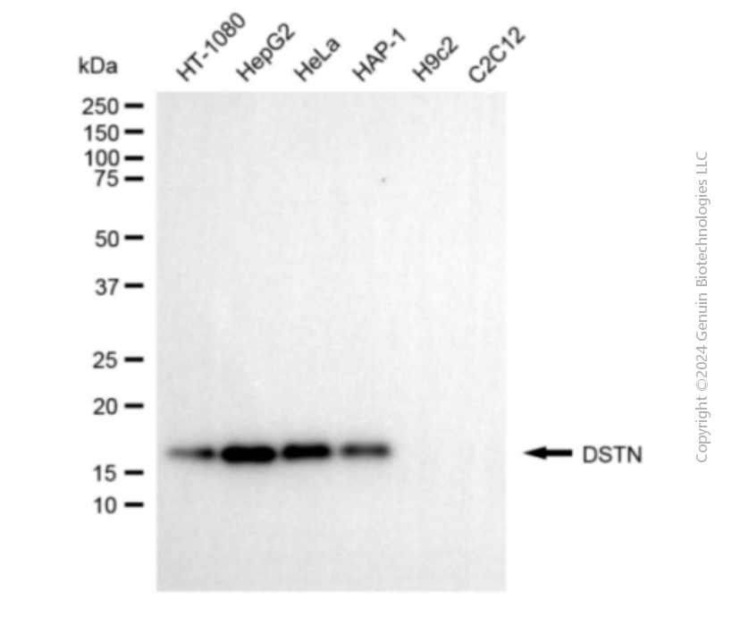 KD-Validated Anti-DSTN Mouse Monoclonal Antibody ABG1905