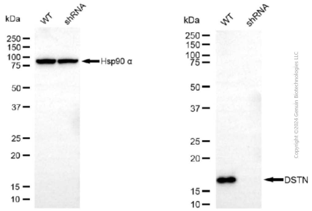 KD-Validated Anti-DSTN Mouse Monoclonal Antibody ABG1905