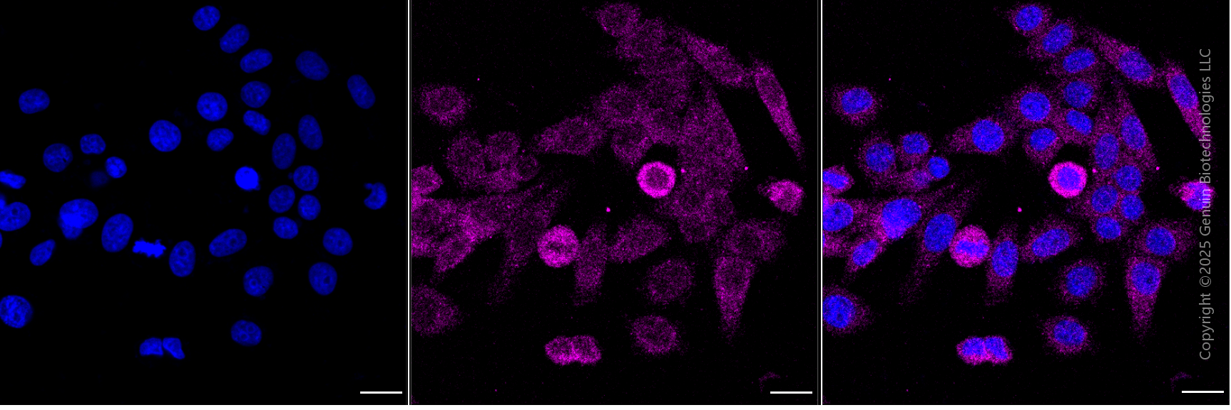 KD-Validated Anti-DSTN Mouse Monoclonal Antibody ABG1906