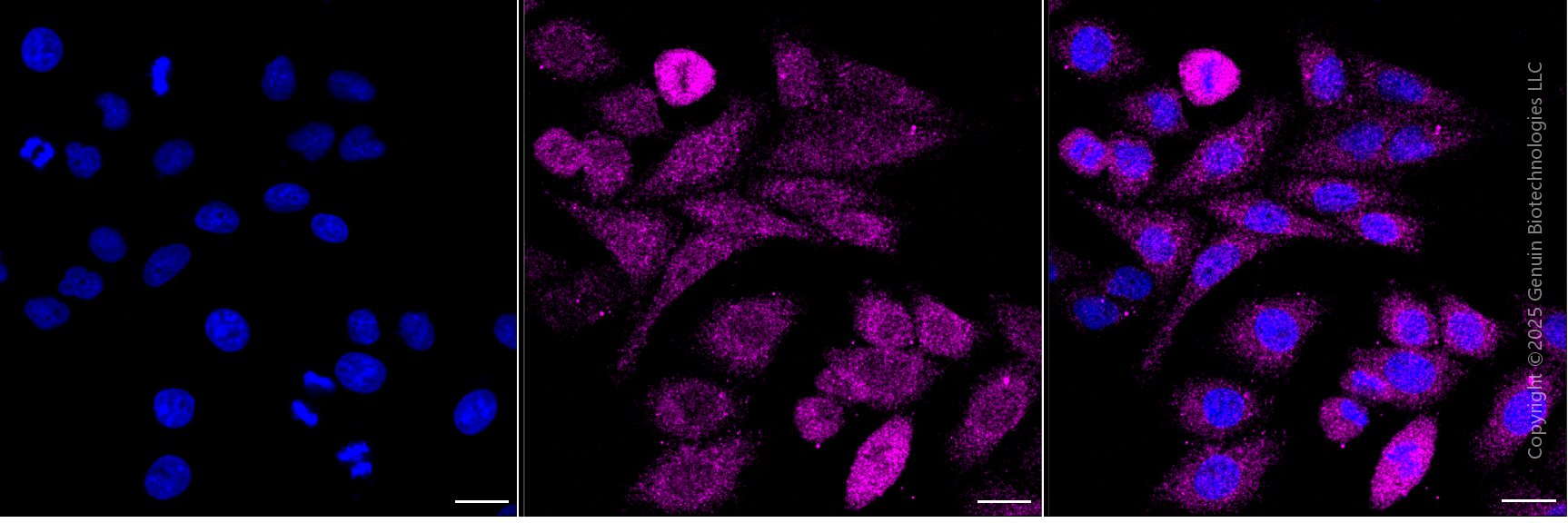 KD-Validated Anti-DSTN Mouse Monoclonal Antibody ABG1907