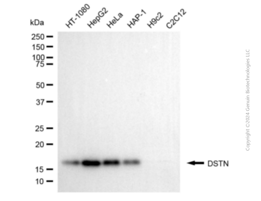 KD-Validated Anti-DSTN Mouse Monoclonal Antibody ABG1907