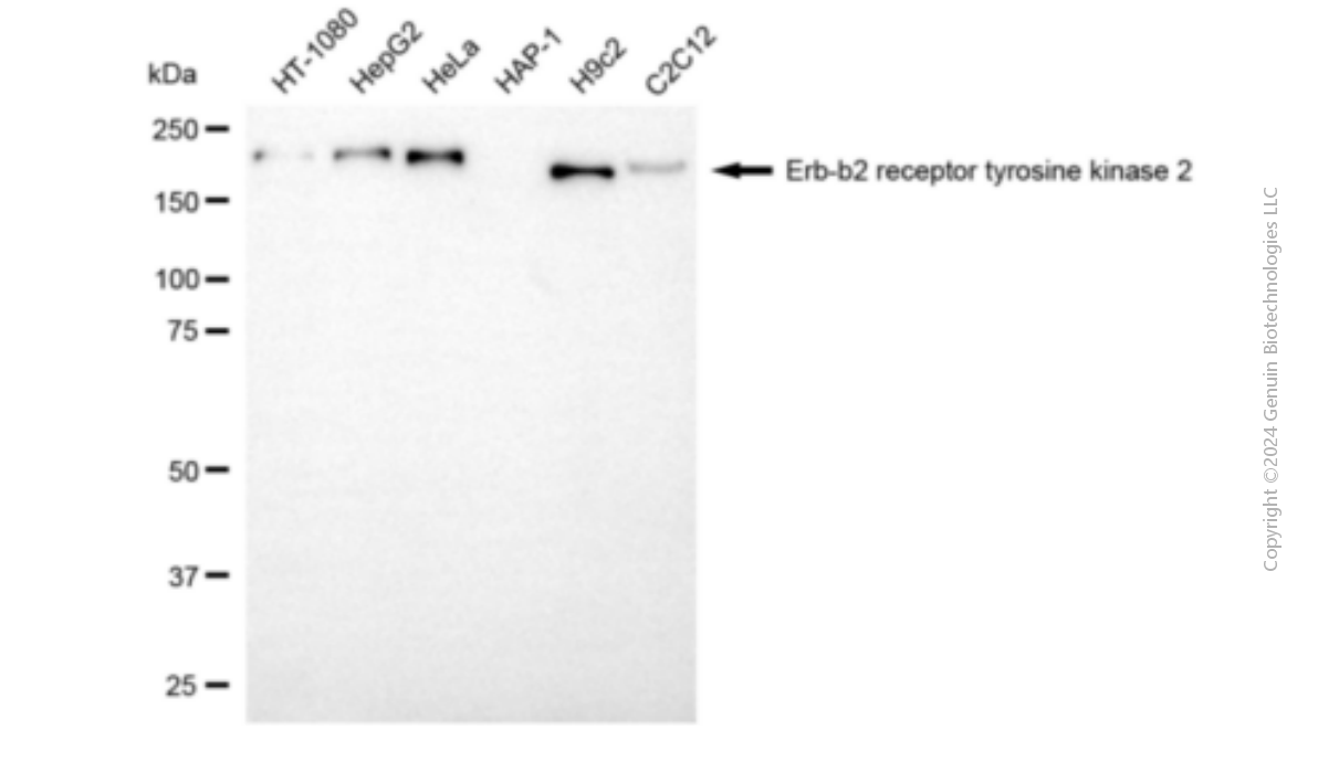 KD-Validated Anti-ERBB2 Mouse Monoclonal Antibody ABG1909