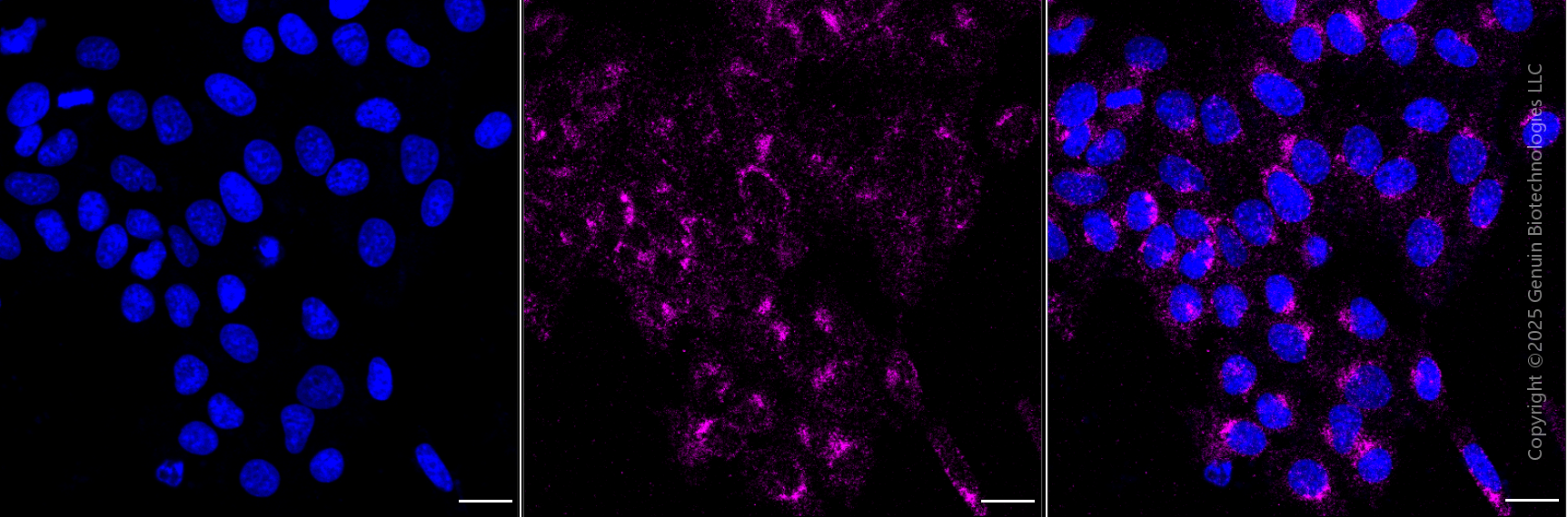 KD-Validated Anti-ERBB2 Mouse Monoclonal Antibody ABG1913