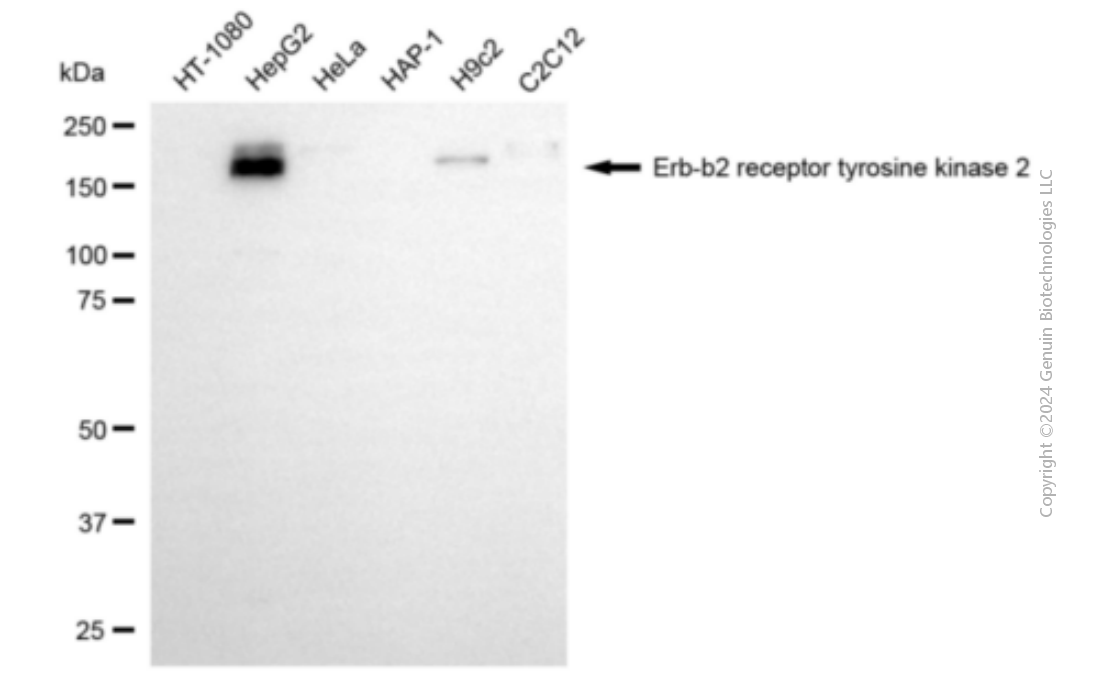 KD-Validated Anti-ERBB2 Mouse Monoclonal Antibody ABG1913