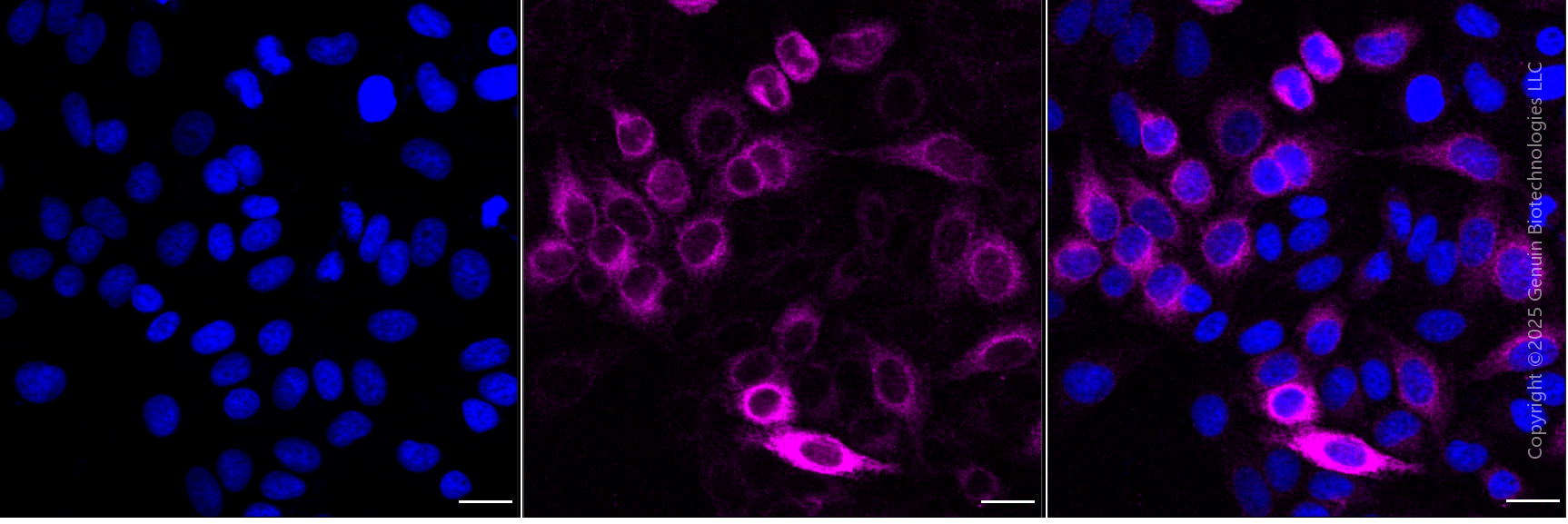 KD-Validated Anti-Epidermal Growth Factor Receptor Mouse Monoclonal Antibody ABG1914