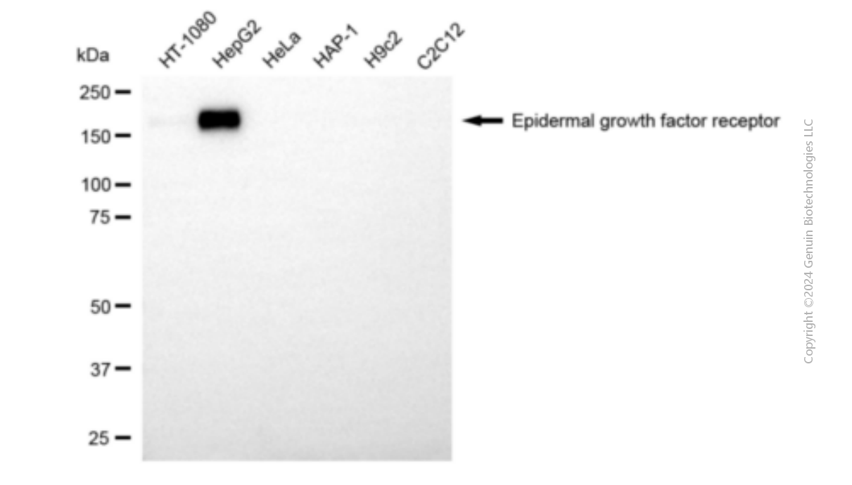 KD-Validated Anti-Epidermal Growth Factor Receptor Mouse Monoclonal Antibody ABG1914