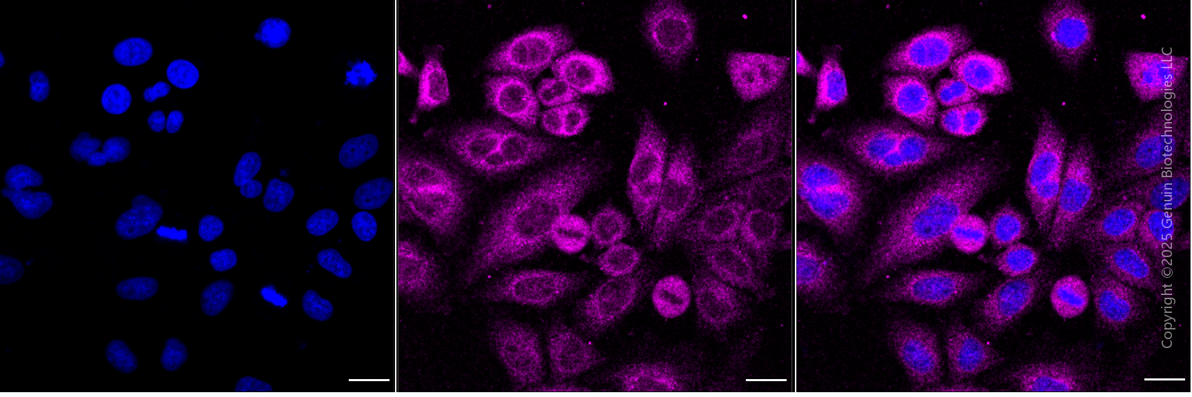 KD-Validated Anti-NFKBIA Mouse Monoclonal Antibody ABG1915