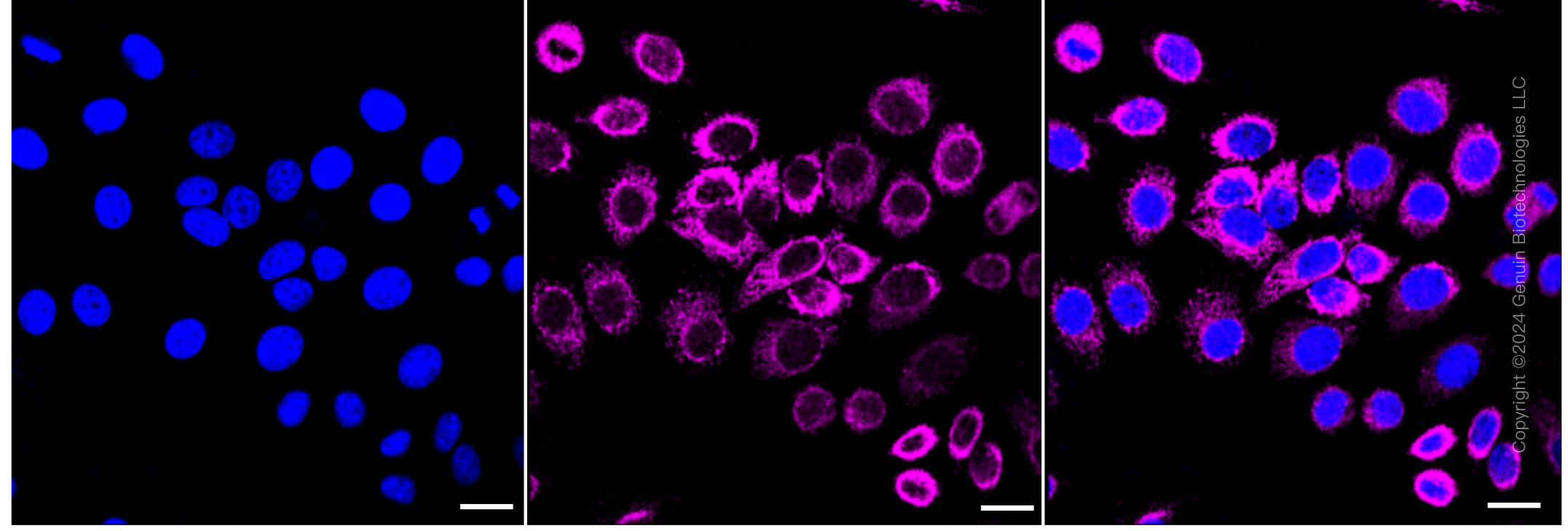 KD-Validated Anti-Glutaminase Rabbit Monoclonal Antibody ABG1918