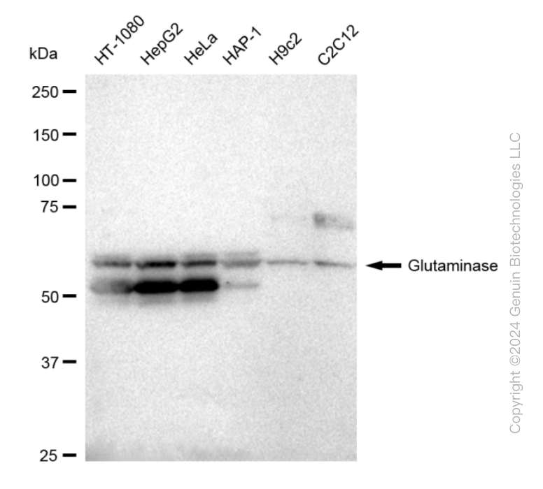 KD-Validated Anti-Glutaminase Rabbit Monoclonal Antibody ABG1918