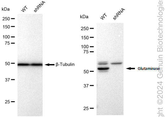 KD-Validated Anti-Glutaminase Rabbit Monoclonal Antibody ABG1918