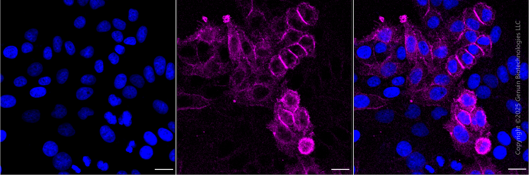 KD-Validated Anti-Epidermal Growth Factor Receptor Mouse Monoclonal Antibody ABG1919