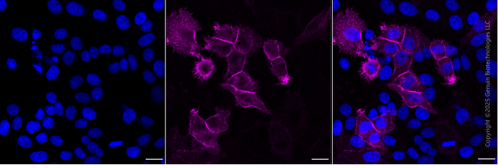 KD-Validated Anti-Epidermal Growth Factor Receptor Mouse Monoclonal Antibody ABG1920