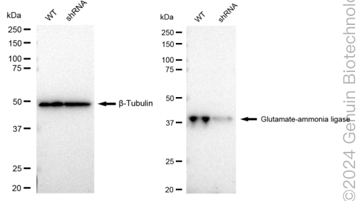 KD-Validated Anti-Glutamate-ammonia ligase Rabbit Monoclonal Antibody ABG1921